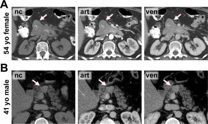 https://cdn.ncbi.nlm.nih.gov/pmc/blobs/355f/11176946/36d3f8754808/gr3.jpg