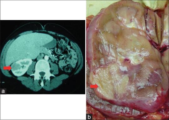 https://cdn.ncbi.nlm.nih.gov/pmc/blobs/355f/5264196/6f65da38b13c/IJU-33-6-g001.jpg