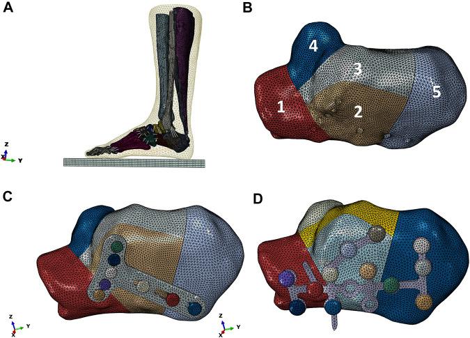 https://cdn.ncbi.nlm.nih.gov/pmc/blobs/355f/8959616/bd2068ed0c91/fbioe-10-791554-g006.jpg