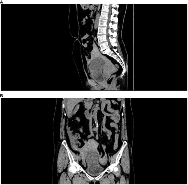 https://cdn.ncbi.nlm.nih.gov/pmc/blobs/3561/9706000/4347239fe98d/fonc-12-948263-g001.jpg