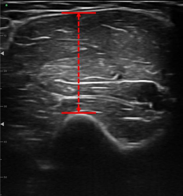 https://cdn.ncbi.nlm.nih.gov/pmc/blobs/356e/11290858/858e54169b54/jpts-36-441-g001.jpg