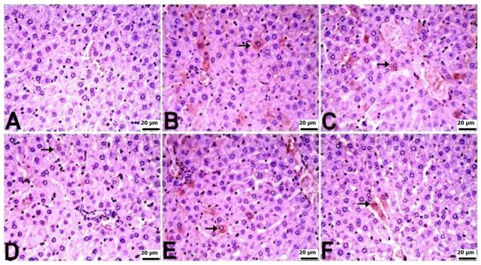 https://cdn.ncbi.nlm.nih.gov/pmc/blobs/356f/11664231/b77a2168d91f/mmr-31-02-13417-g04.jpg