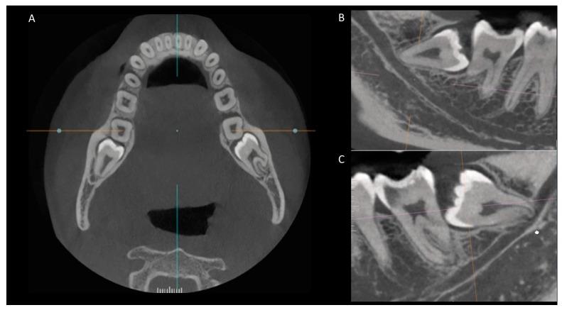 https://cdn.ncbi.nlm.nih.gov/pmc/blobs/3570/10855352/4ab5b80c06f2/diagnostics-14-00260-g002.jpg