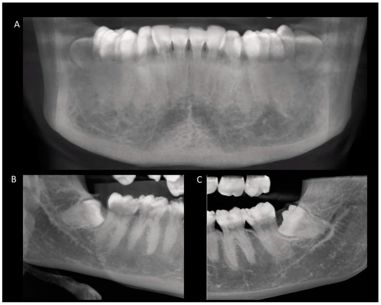 https://cdn.ncbi.nlm.nih.gov/pmc/blobs/3570/10855352/6096edea99f9/diagnostics-14-00260-g001.jpg
