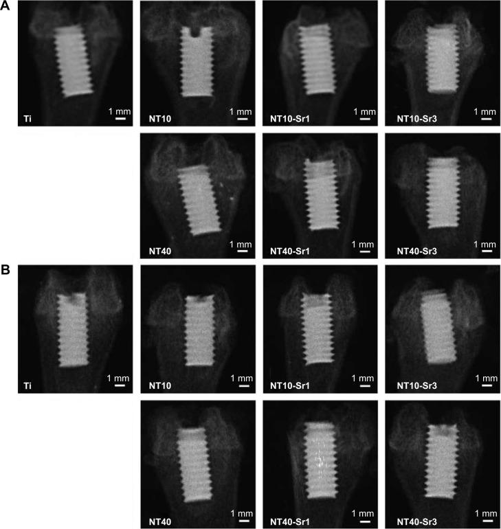 https://cdn.ncbi.nlm.nih.gov/pmc/blobs/357d/4798202/8de5e515101e/ijn-11-1003Fig2.jpg