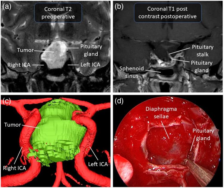 https://cdn.ncbi.nlm.nih.gov/pmc/blobs/3580/12344518/5eb83332f4ec/JBO-030-080901-g001.jpg
