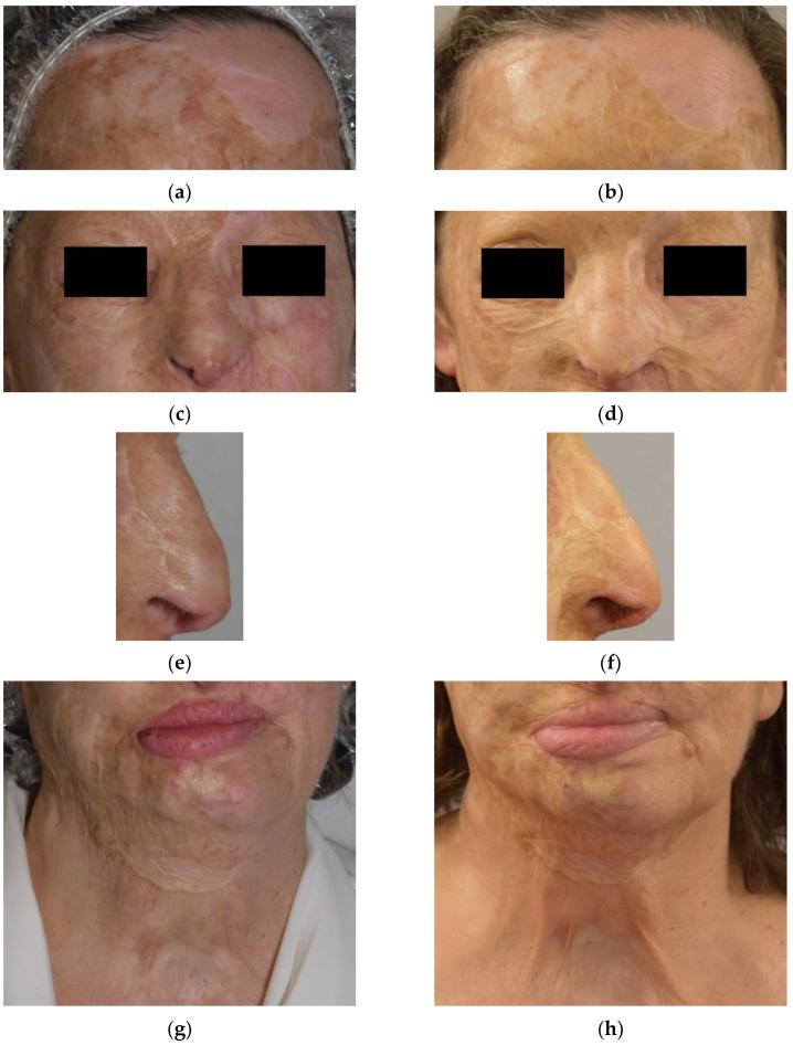 https://cdn.ncbi.nlm.nih.gov/pmc/blobs/3581/9774184/b025bccd3a41/bioengineering-09-00799-g001.jpg