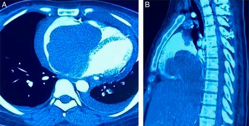 https://cdn.ncbi.nlm.nih.gov/pmc/blobs/3586/10473319/199bf3fa4235/ms9-85-4593-g003.jpg