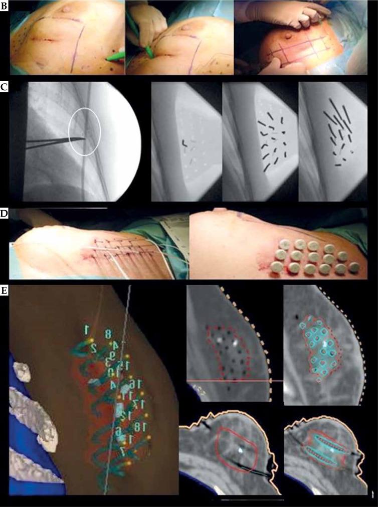 https://cdn.ncbi.nlm.nih.gov/pmc/blobs/3587/10993897/4aad9e7946e8/JCB-16-52452-g002.jpg
