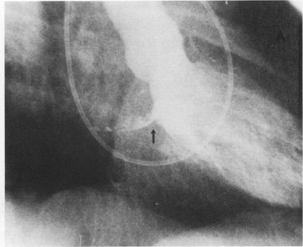 https://cdn.ncbi.nlm.nih.gov/pmc/blobs/3589/287861/14f8ee08a1bd/cardiodis00007-0019-a.jpg