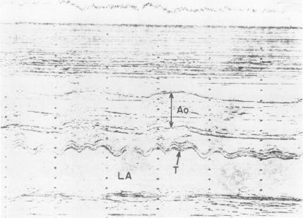 https://cdn.ncbi.nlm.nih.gov/pmc/blobs/3589/287861/ffccabd1d729/cardiodis00007-0016-a.jpg