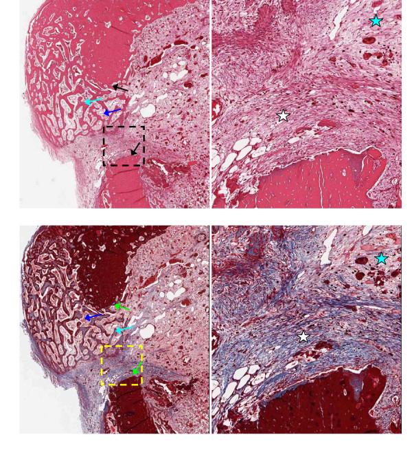 https://cdn.ncbi.nlm.nih.gov/pmc/blobs/358a/3009953/6b5580d1d1a1/1471-2482-10-37-5.jpg