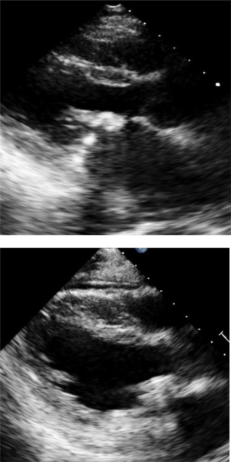 https://cdn.ncbi.nlm.nih.gov/pmc/blobs/3592/10786046/ad164be634b1/gh-19-1-1285-g3.jpg