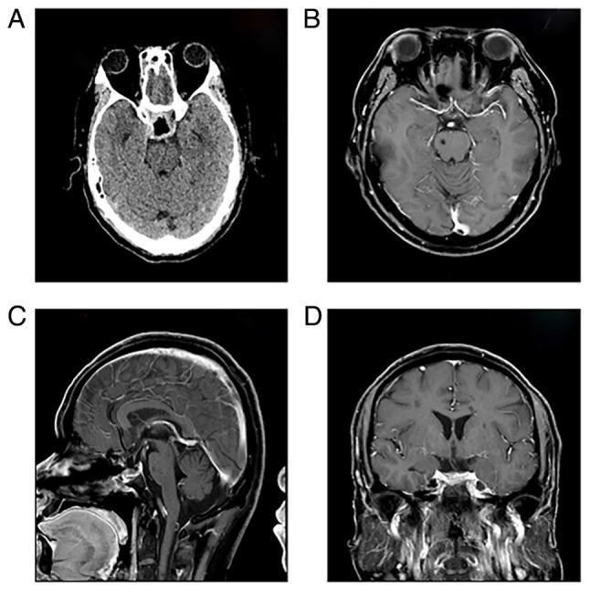 https://cdn.ncbi.nlm.nih.gov/pmc/blobs/359c/12067521/aa5d04198f1e/etm-29-06-12874-g01.jpg