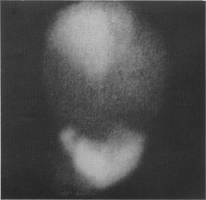 https://cdn.ncbi.nlm.nih.gov/pmc/blobs/359e/1628818/dc9958d56aa8/archdisch00728-0097-a.jpg