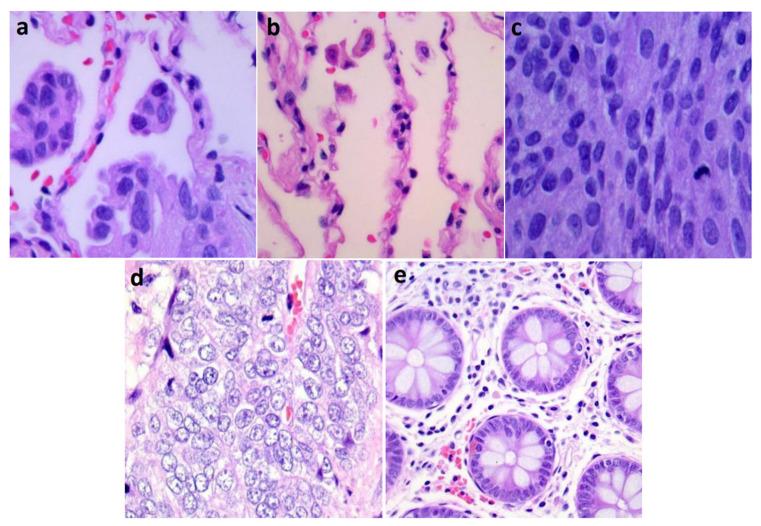 https://cdn.ncbi.nlm.nih.gov/pmc/blobs/35a6/10178684/212b91e3405f/diagnostics-13-01594-g001.jpg