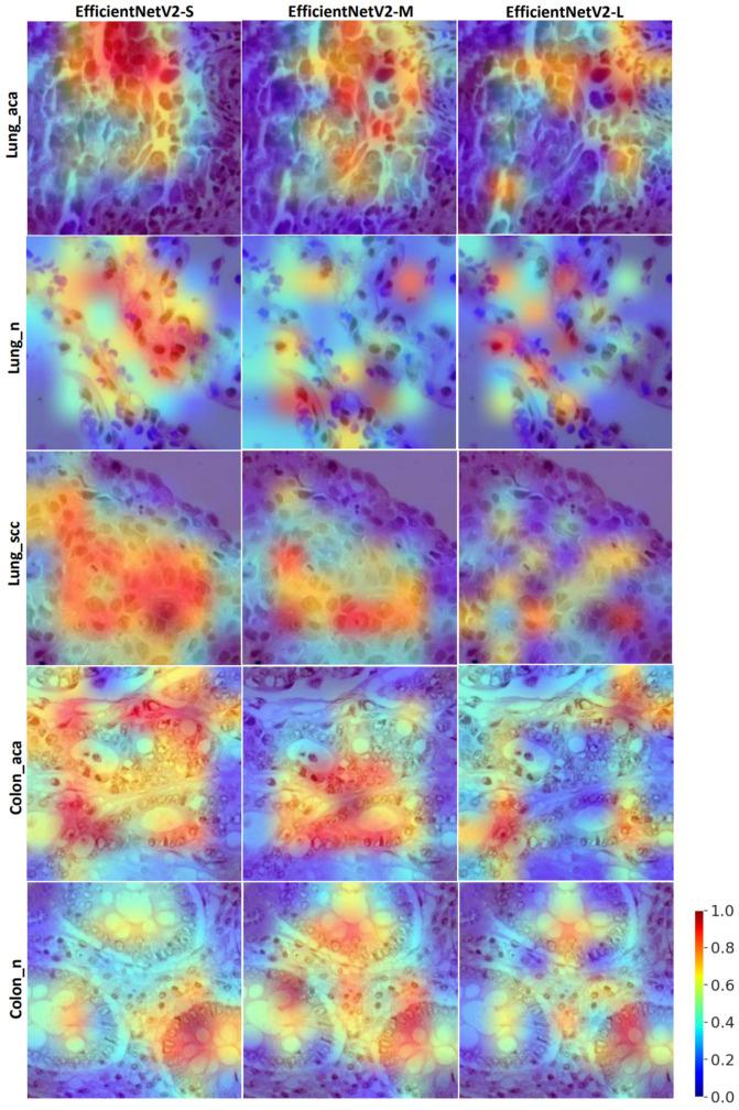 https://cdn.ncbi.nlm.nih.gov/pmc/blobs/35a6/10178684/8e54172f382b/diagnostics-13-01594-g004.jpg