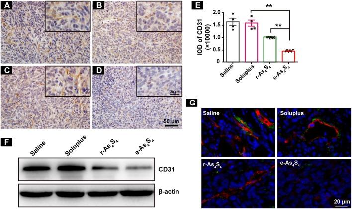 https://cdn.ncbi.nlm.nih.gov/pmc/blobs/35ab/6498897/a09b57de8dd2/fonc-09-00333-g0004.jpg