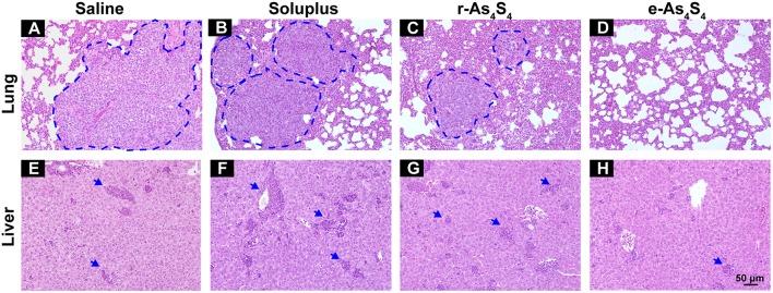 https://cdn.ncbi.nlm.nih.gov/pmc/blobs/35ab/6498897/d5a01eb36205/fonc-09-00333-g0006.jpg