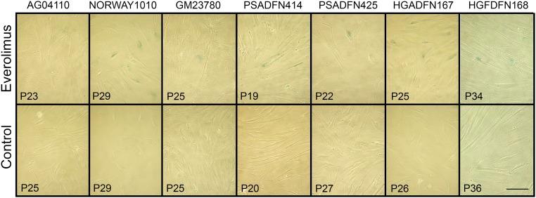 https://cdn.ncbi.nlm.nih.gov/pmc/blobs/35b7/5910873/f461b7610541/pnas.1802811115fig06.jpg