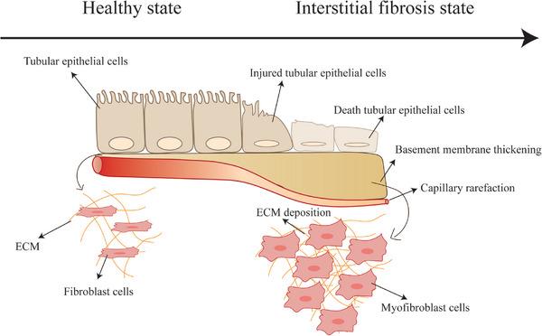 https://cdn.ncbi.nlm.nih.gov/pmc/blobs/35c9/11973949/ffb6a56f6378/ADHM-14-0-g007.jpg