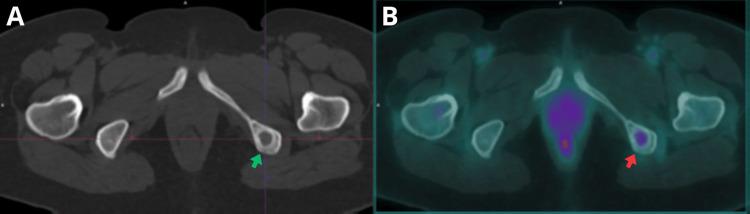 https://cdn.ncbi.nlm.nih.gov/pmc/blobs/35c9/12406753/f340ec78631d/cureus-0017-00000089326-i02.jpg