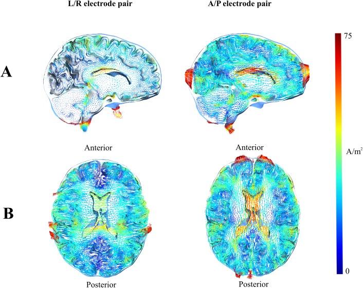 https://cdn.ncbi.nlm.nih.gov/pmc/blobs/35ca/5467909/d892f3b951ce/pone.0179214.g006.jpg
