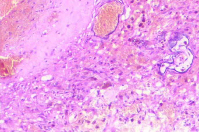 https://cdn.ncbi.nlm.nih.gov/pmc/blobs/35ce/11449536/254024385169/jcen-2024-e2023-04-006f2.jpg