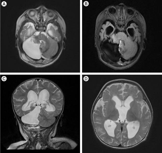 https://cdn.ncbi.nlm.nih.gov/pmc/blobs/35ce/11449536/a64ab108f7a7/jcen-2024-e2023-04-006f3.jpg