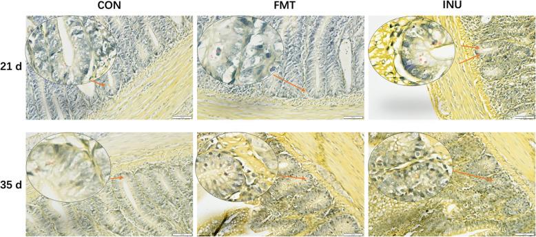 https://cdn.ncbi.nlm.nih.gov/pmc/blobs/35d3/11998286/1b2eb6962f54/40168_2025_2084_Fig3_HTML.jpg