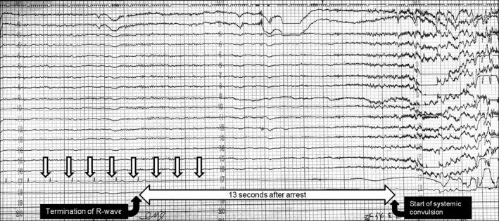 https://cdn.ncbi.nlm.nih.gov/pmc/blobs/35dd/5931353/1cd14a85ac1e/JGF2-19-109-g001.jpg