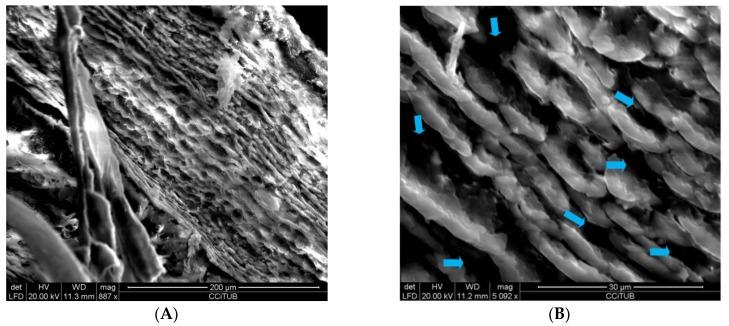 https://cdn.ncbi.nlm.nih.gov/pmc/blobs/35dd/7076632/4a369067f3ea/pharmaceutics-12-00149-g001.jpg