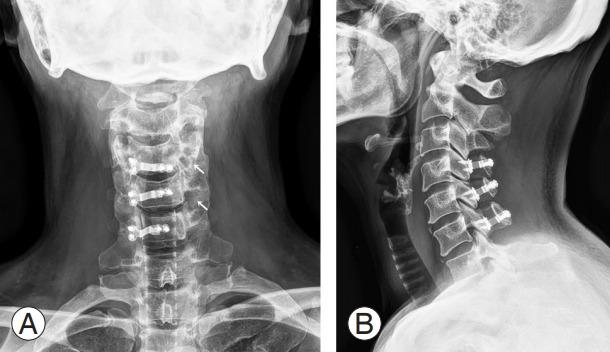 https://cdn.ncbi.nlm.nih.gov/pmc/blobs/35de/7595811/90d2beb78d42/asj-2020-0490f2.jpg