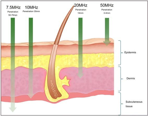 https://cdn.ncbi.nlm.nih.gov/pmc/blobs/35e4/4964074/dccfc317ca0b/41038_2016_36_Fig6_HTML.jpg