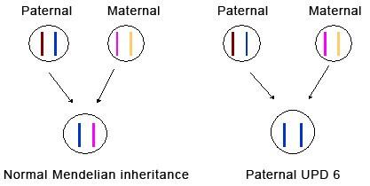 https://cdn.ncbi.nlm.nih.gov/pmc/blobs/35e6/1847805/4cac469f6d5c/1750-1172-2-12-1.jpg