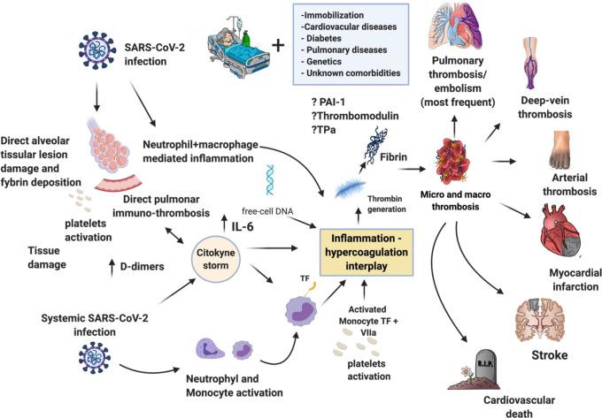 https://cdn.ncbi.nlm.nih.gov/pmc/blobs/35ec/7357049/4b0a4c79e618/10.1177_1076029620936350-fig1.jpg