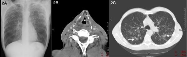 https://cdn.ncbi.nlm.nih.gov/pmc/blobs/35f0/2803812/af26432cb019/1752-1947-3-9288-2.jpg