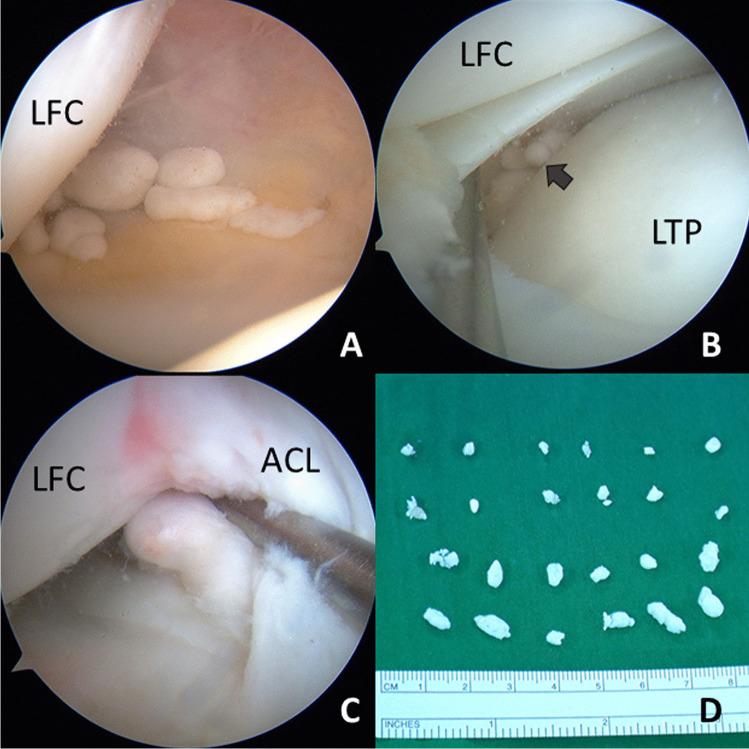https://cdn.ncbi.nlm.nih.gov/pmc/blobs/35f1/9154203/c36faa101389/10067_2022_6224_Fig3_HTML.jpg