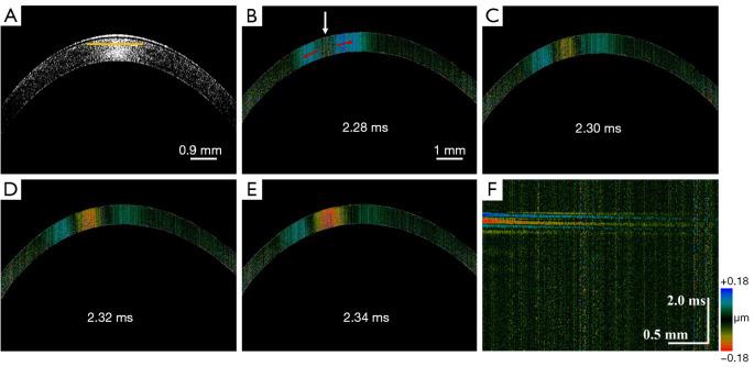 https://cdn.ncbi.nlm.nih.gov/pmc/blobs/35f7/11485357/2acf9c632636/qims-14-10-7640-f5.jpg