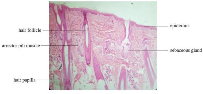 https://cdn.ncbi.nlm.nih.gov/pmc/blobs/35f9/10232955/c858c6f03eb1/fmed-10-1139607-g0002.jpg