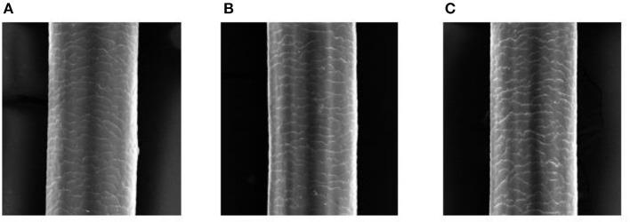 https://cdn.ncbi.nlm.nih.gov/pmc/blobs/35f9/10232955/ce990414cf4c/fmed-10-1139607-g0003.jpg