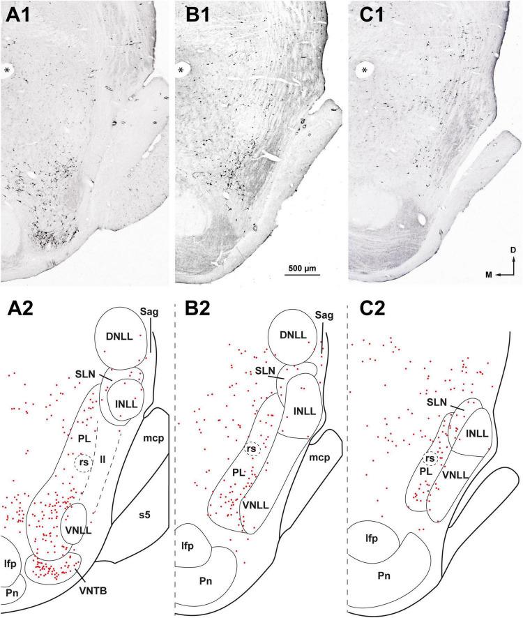 https://cdn.ncbi.nlm.nih.gov/pmc/blobs/35fc/10445163/112f4bdfd7a9/fnana-17-1242245-g004.jpg
