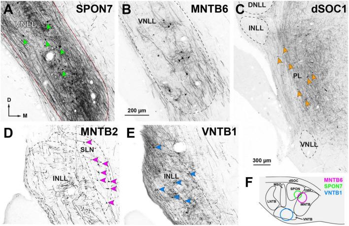 https://cdn.ncbi.nlm.nih.gov/pmc/blobs/35fc/10445163/3f4f96d5a8de/fnana-17-1242245-g009.jpg