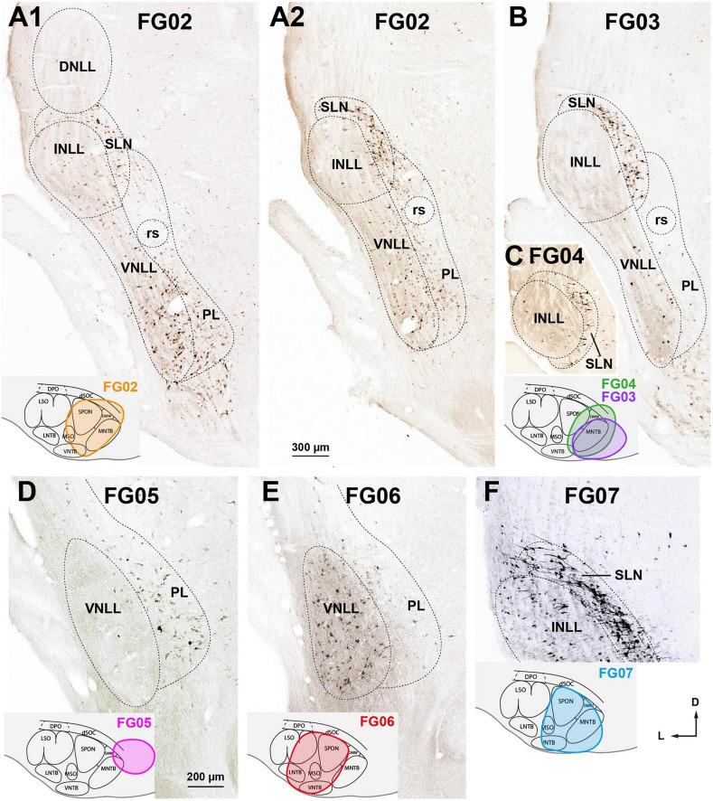https://cdn.ncbi.nlm.nih.gov/pmc/blobs/35fc/10445163/530ad613dde6/fnana-17-1242245-g007.jpg