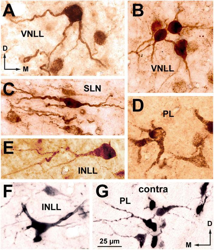 https://cdn.ncbi.nlm.nih.gov/pmc/blobs/35fc/10445163/7ccce3b3b31b/fnana-17-1242245-g006.jpg