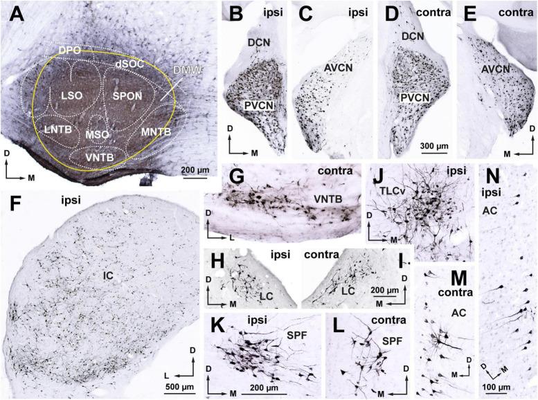 https://cdn.ncbi.nlm.nih.gov/pmc/blobs/35fc/10445163/880eff266c9f/fnana-17-1242245-g002.jpg