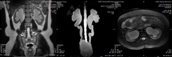 https://cdn.ncbi.nlm.nih.gov/pmc/blobs/35ff/4046082/e50f46623b13/1471-2490-14-38-5.jpg