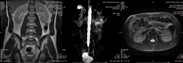 https://cdn.ncbi.nlm.nih.gov/pmc/blobs/35ff/4046082/f71e0e26fb77/1471-2490-14-38-1.jpg