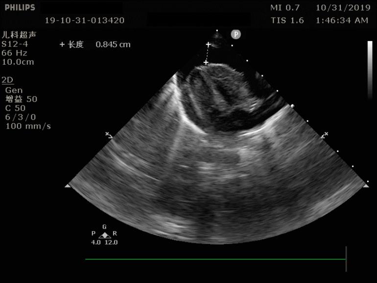 https://cdn.ncbi.nlm.nih.gov/pmc/blobs/3602/7829730/37851b3be279/WJCC-9-602-g001.jpg