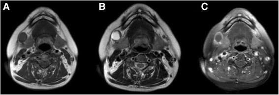 https://cdn.ncbi.nlm.nih.gov/pmc/blobs/3606/5706288/6c9264812a98/12903_2017_435_Fig1_HTML.jpg